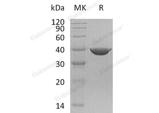 Recombinant Human Transaldolase/TALDO1 Protein (His Tag) - ABMIUM