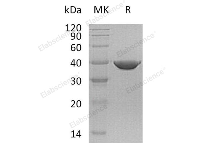 Recombinant Human Transaldolase/TALDO1 Protein (His Tag) - ABMIUM