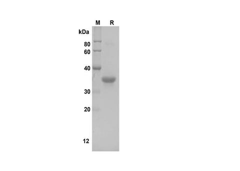 SDS-PAGE analysis of Human MCSF proteins, 2 μg/lane of Recombinant Human MCSF proteins was resolved with SDS-PAGE under reducing conditions, showing bands at 37 kDa.