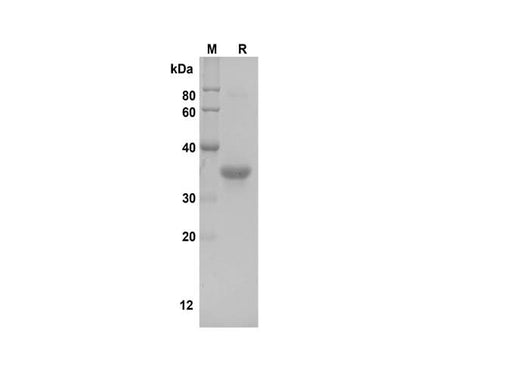 SDS-PAGE analysis of Human MCSF proteins, 2 μg/lane of Recombinant Human MCSF proteins was resolved with SDS-PAGE under reducing conditions, showing bands at 37 kDa.