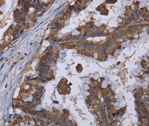 Anti-Human/Mouse/Rat MT3 Antibody - ABMIUM