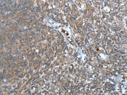 Immunohistochemistry of paraffin-embedded Human tonsil tissue using WISP2 Polyclonal Antibody at dilution of 1:45(×200)