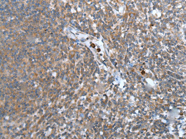 Immunohistochemistry of paraffin-embedded Human tonsil tissue using WISP2 Polyclonal Antibody at dilution of 1:45(×200)