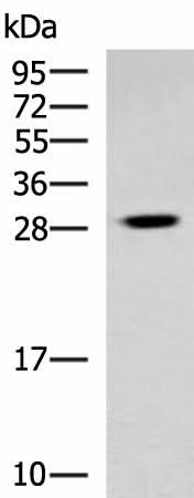Western blot analysis of Human cerebrum tissue lysate using TBCB Polyclonal Antibody at dilution of 1:800