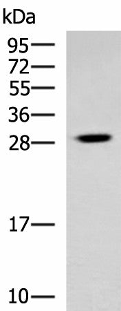 Western blot analysis of Human cerebrum tissue lysate using TBCB Polyclonal Antibody at dilution of 1:800