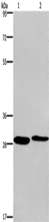 Anti-Human/Mouse/Rat CPSF4 Antibody - ABMIUM