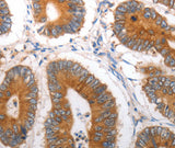 Anti-Human SLC12A6 Antibody - ABMIUM