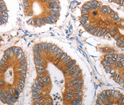 Anti-Human SLC12A6 Antibody