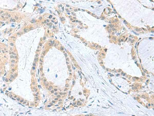 Anti-Human/Mouse PDE6D Antibody