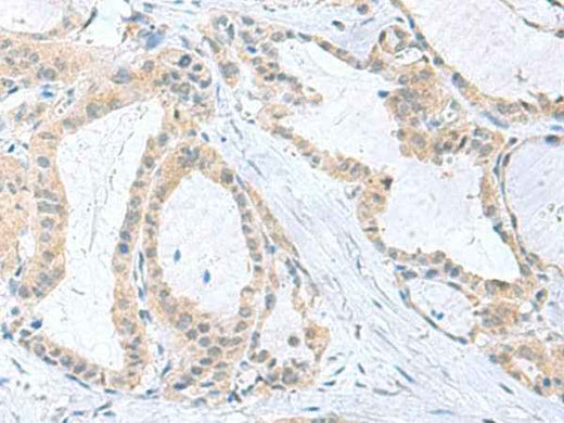 Anti-Human/Mouse PDE6D Antibody