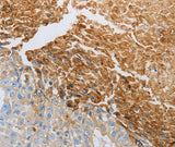 Anti-Human/Mouse/Rat RTN4 Antibody - ABMIUM