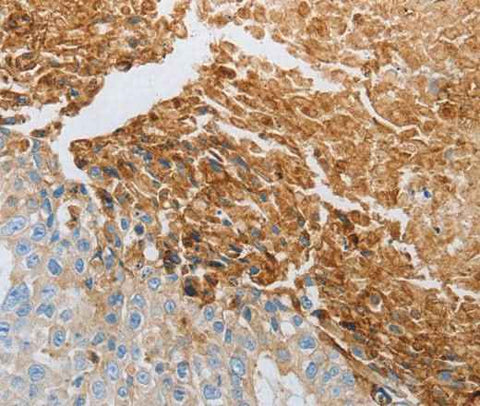 Anti-Human/Mouse/Rat RTN4 Antibody
