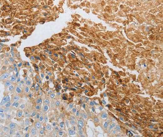 Anti-Human/Mouse/Rat RTN4 Antibody