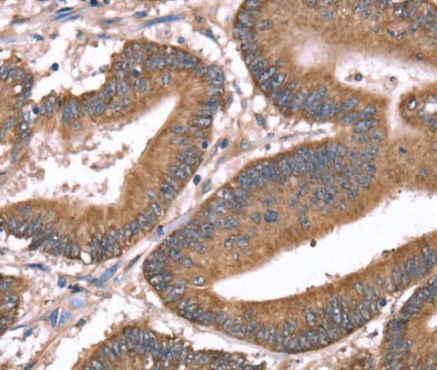 Anti-Human HRG Antibody - ABMIUM