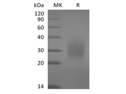 Recombinant Human CD79A(C-6His) - ABMIUM