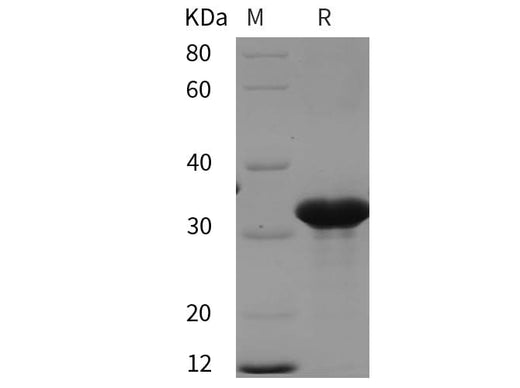 SDS-PAGE analysis of Human RAB27A proteins, 2 μg/lane of Recombinant Human RAB27A proteins was resolved with SDS-PAGE under reducing conditions, showing bands at 32 kDa.