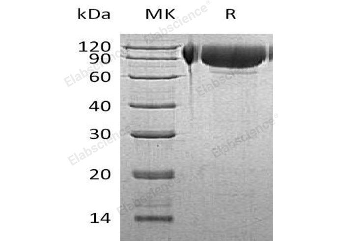 Recombinant Human GNS Protein (His Tag) - ABMIUM