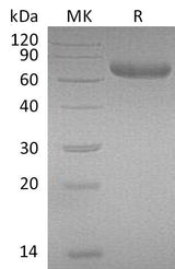 Recombinant Mouse PRLR/Prolactin Receptor Protein (Fc Tag) - ABMIUM