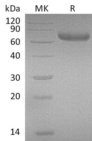 Recombinant Mouse PRLR/Prolactin Receptor Protein (Fc Tag) - ABMIUM