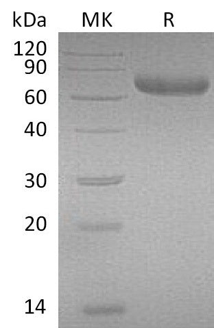 Recombinant Mouse PRLR/Prolactin Receptor Protein (Fc Tag) - ABMIUM