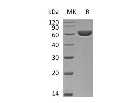 Recombinant Mouse Carboxylesterase 1D/SES1D Protein (His Tag) - ABMIUM