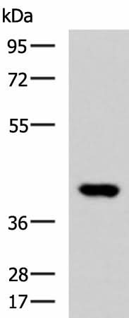 Western blot analysis of Human heart tissue lysate using FOXI1 Polyclonal Antibody at dilution of 1:800