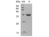 Recombinant Human Annexin A13/ANXA13 Protein - ABMIUM