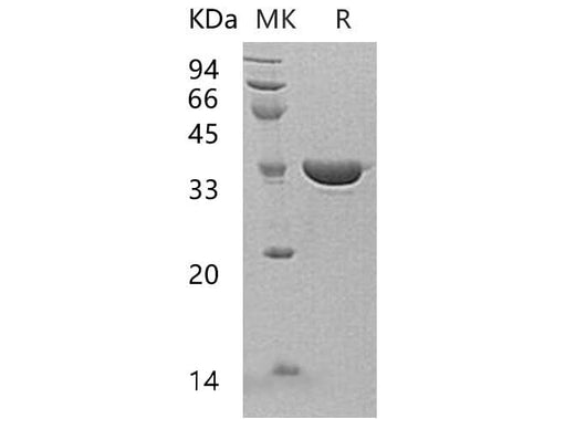 Recombinant Human Annexin A13/ANXA13 Protein - ABMIUM