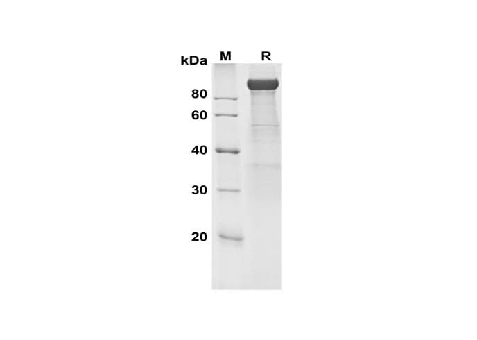 SDS-PAGE analysis of Human Fibroblast Activation Protein α/FAP proteins, 2 μg/lane of Recombinant Human Fibroblast Activation Protein α/FAP proteins was resolved with SDS-PAGE under reducing conditions, showing bands at 110 kDa.