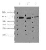 Western Blot analysis of 1) Hela, 2) Mouse kidney, 3) Mouse brain using CK-7 Monoclonal Antibody at dilution of 1:2000.