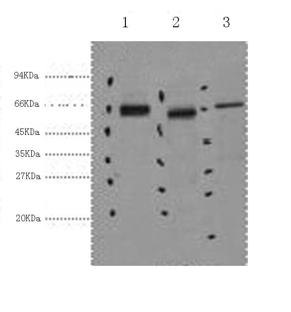 Western Blot analysis of 1) Hela, 2) Mouse kidney, 3) Mouse brain using CK-7 Monoclonal Antibody at dilution of 1:2000.