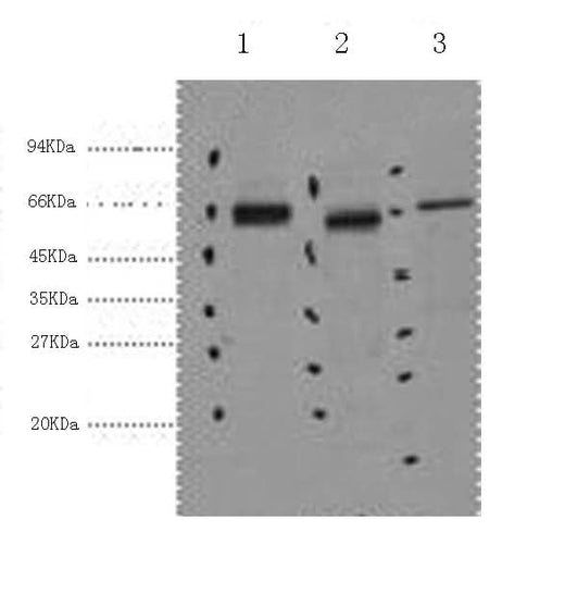 Western Blot analysis of 1) Hela, 2) Mouse kidney, 3) Mouse brain using CK-7 Monoclonal Antibody at dilution of 1:2000.