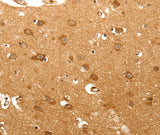 Anti-Human/Mouse/Rat MAP1B Antibody - ABMIUM