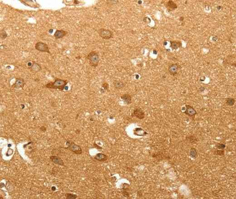 Anti-Human/Mouse/Rat MAP1B Antibody