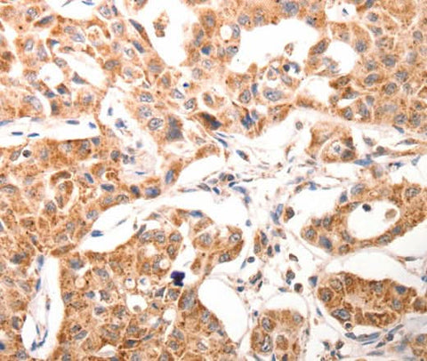 Anti-Human BGLAP Antibody - ABMIUM
