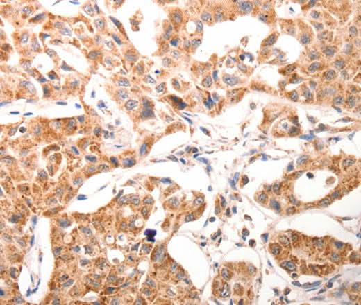 Anti-Human BGLAP Antibody - ABMIUM