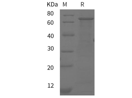 SDS-PAGE analysis of Mouse Cdh5 proteins, 2 μg/lane of Recombinant Mouse Cdh5 proteins was resolved with SDS-PAGE under reducing conditions, showing bands at 65 kDa.