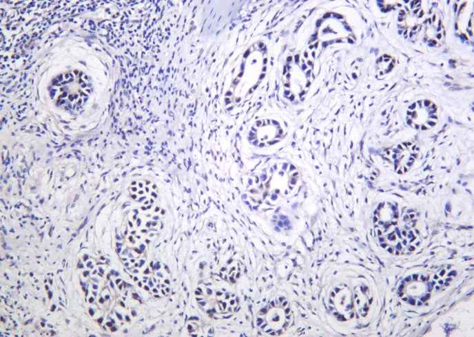Anti-Human/Mouse/Rat THOC1 Antibody [B1011] - ABMIUM