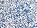 Immunohistochemistry of paraffin-embedded Human tonsil tissue using EIF4A2 Polyclonal Antibody at dilution of 1:70(×200)