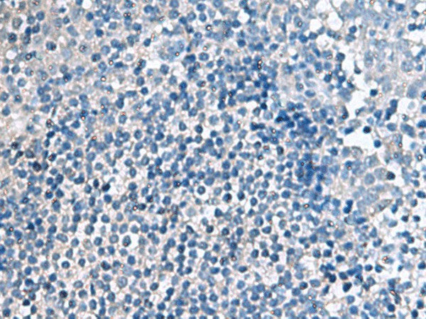 Immunohistochemistry of paraffin-embedded Human tonsil tissue using EIF4A2 Polyclonal Antibody at dilution of 1:70(×200)