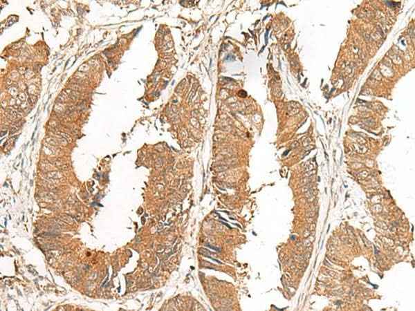 Anti-Human/Mouse/Rat GCC2 Antibody