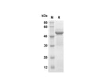 SDS-PAGE analysis of Mouse Galectin-7 proteins, 2 μg/lane of Recombinant Mouse Galectin-7 proteins was resolved with SDS-PAGE under reducing conditions, showing bands at 45 kDa.