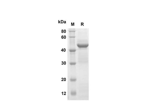 SDS-PAGE analysis of Mouse Galectin-7 proteins, 2 μg/lane of Recombinant Mouse Galectin-7 proteins was resolved with SDS-PAGE under reducing conditions, showing bands at 45 kDa.