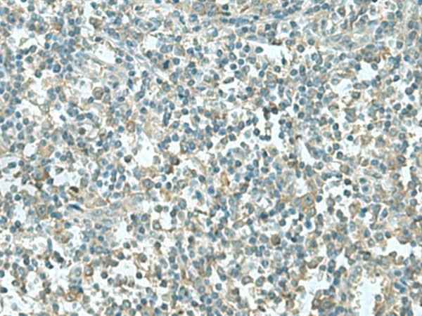 Anti-Human/Mouse/Rat CCT5 Antibody