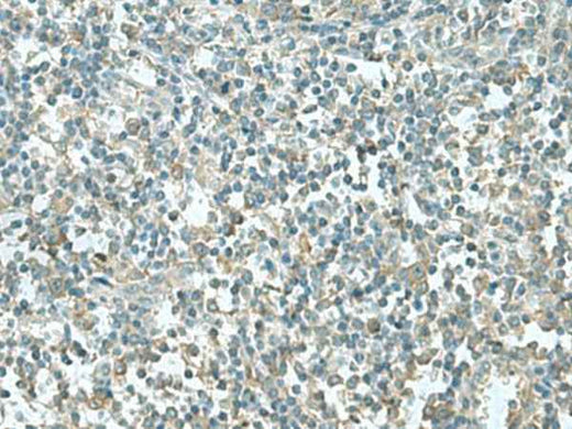 Anti-Human/Mouse/Rat CCT5 Antibody