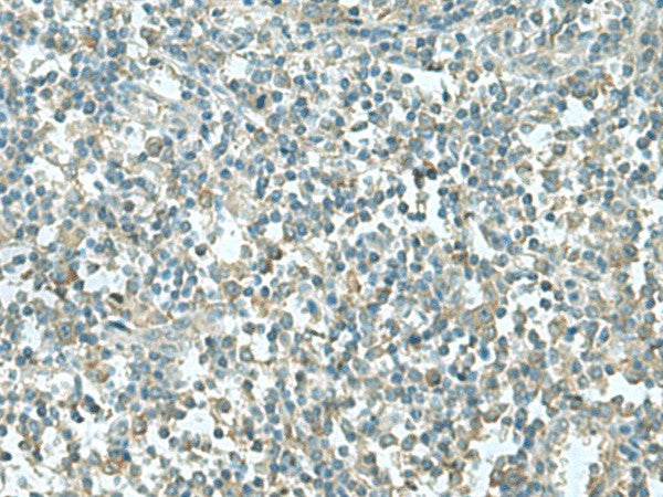 Immunohistochemistry of paraffin-embedded Human tonsil tissue using CCT5 Polyclonal Antibody at dilution of 1:55(×200)