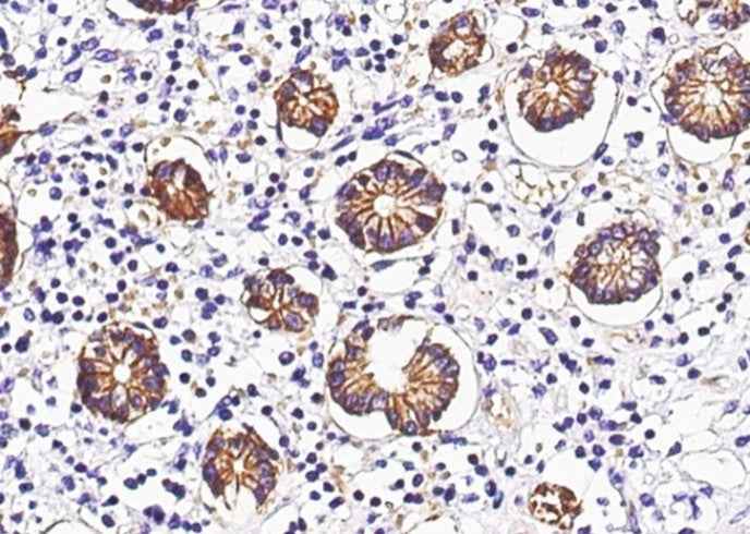 Anti-Human GPA33 Antibody [A1239] - ABMIUM
