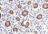 Anti-Human GPA33 Antibody [A1239] - ABMIUM
