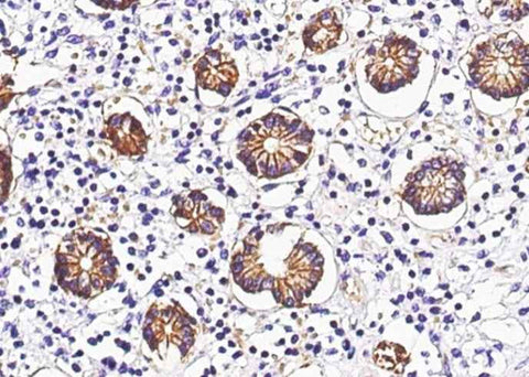 Anti-Human GPA33 Antibody [A1239] - ABMIUM