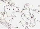 Anti-Human IL1B Antibody [A859] - ABMIUM